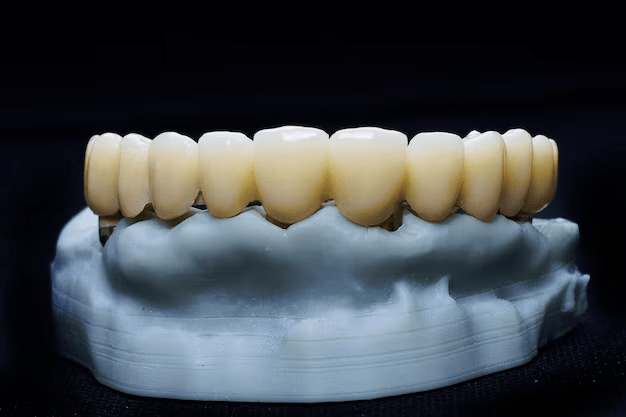 dental prosthesis maxillary