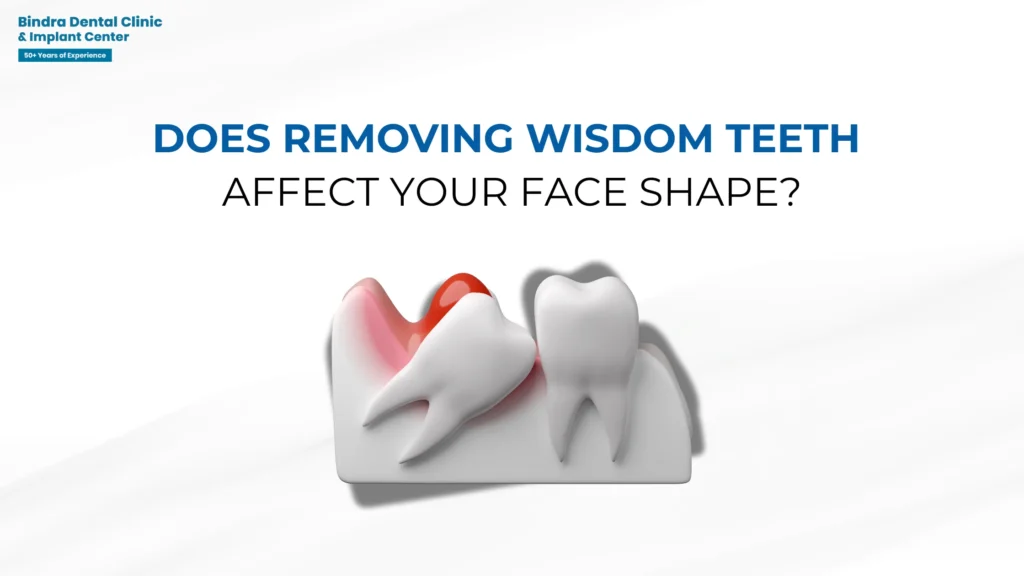 Does Removing Wisdom Teeth Affect Your Face Shape?
