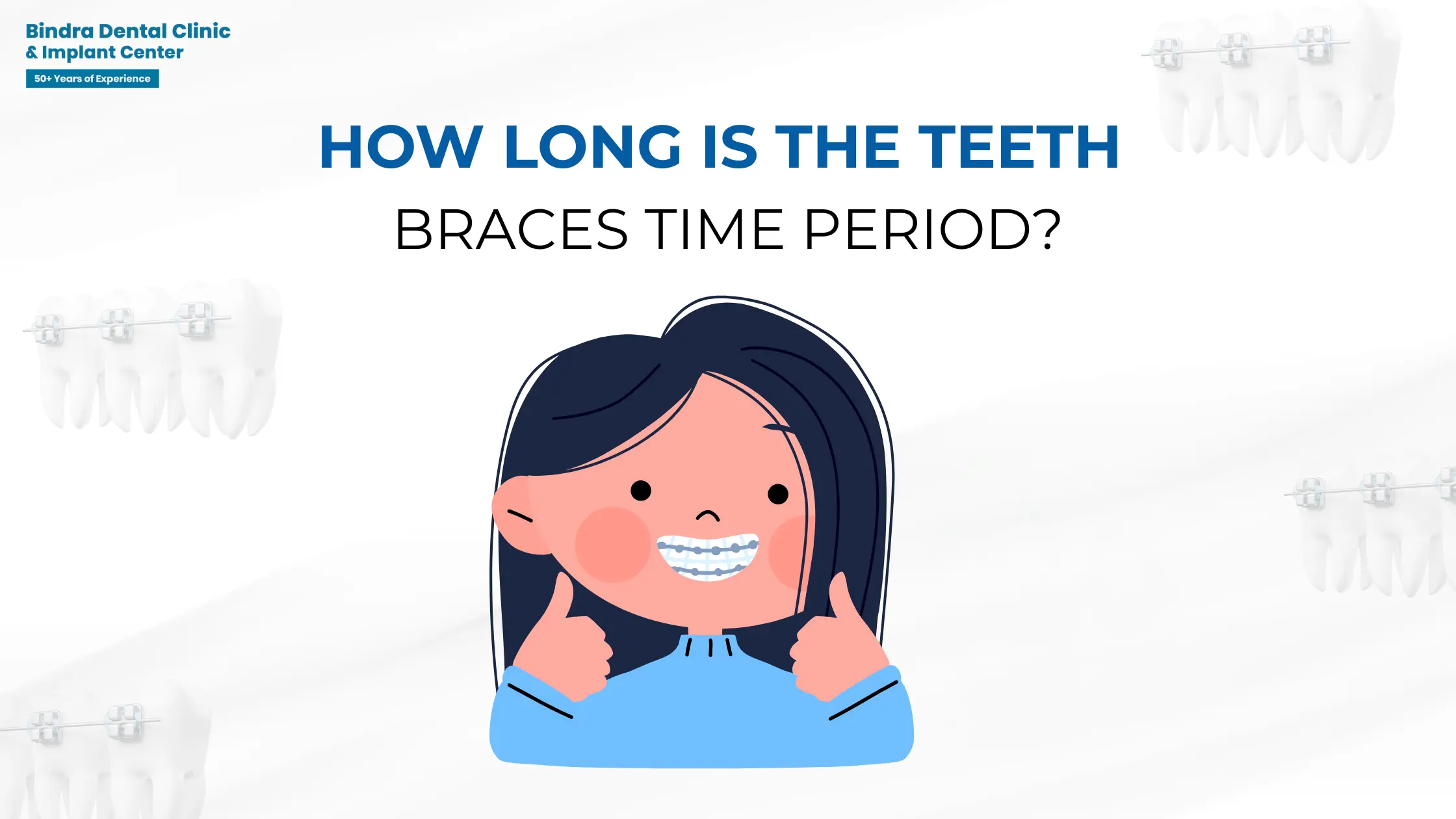 How Long Is the Teeth Braces Time Period