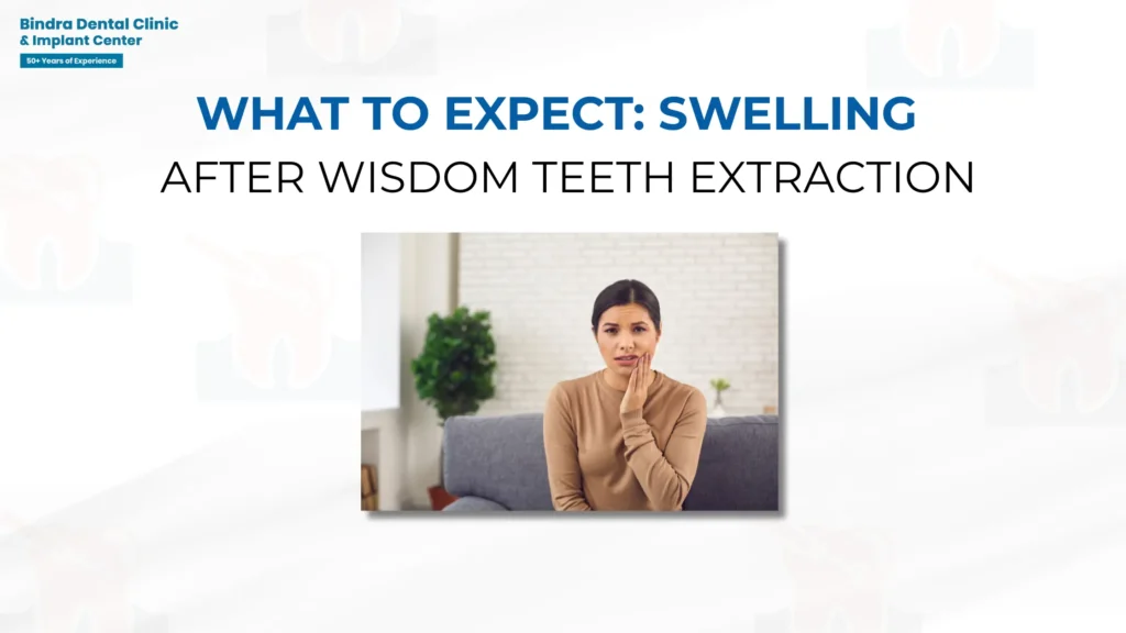 What to Expect Swelling After Wisdom Teeth Extraction